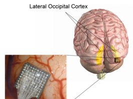 Logran que una persona ciega recupere parte de la visión con microestimulación cerebral